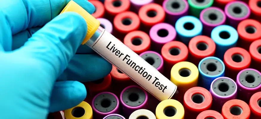 Liver Function Tests: Purpose, Procedure, and Results