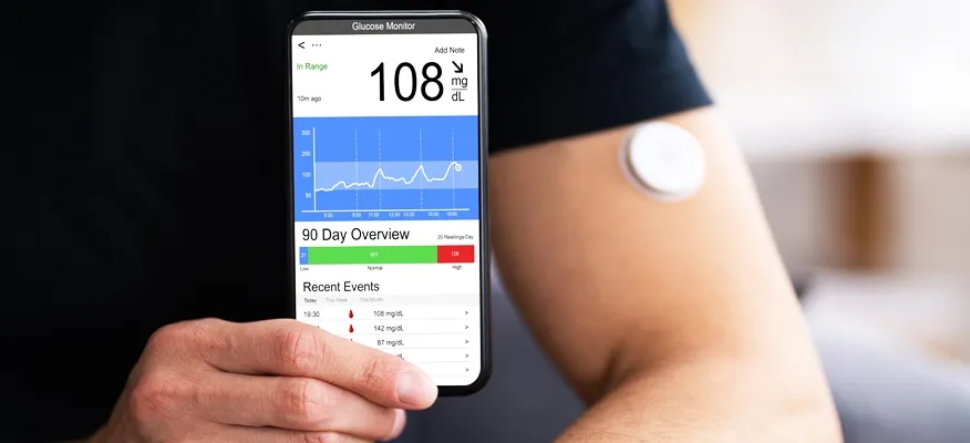 Continuous glucose monitoring for diabetes management