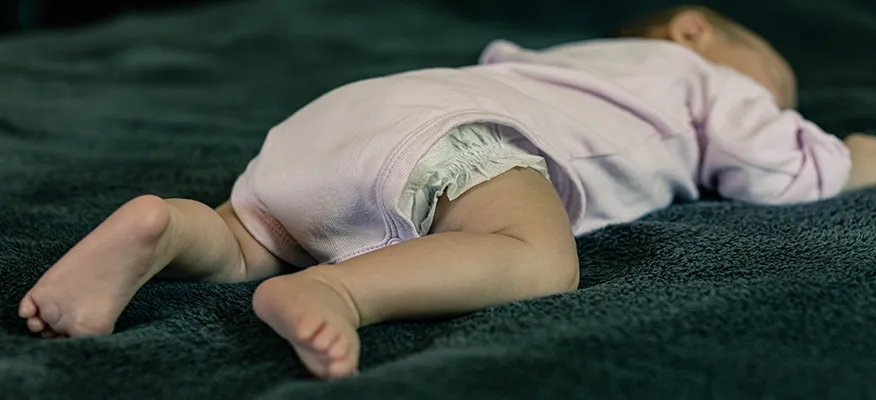 Causes of Sudden Infant Death Syndrome (SIDS)