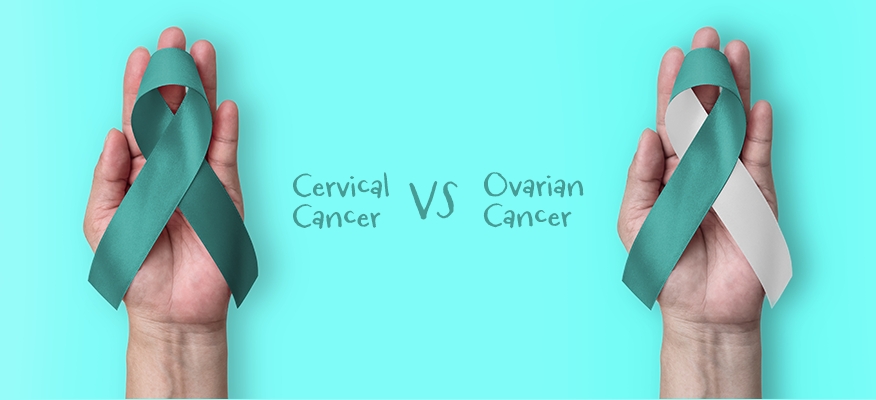 Ovarian Cancer